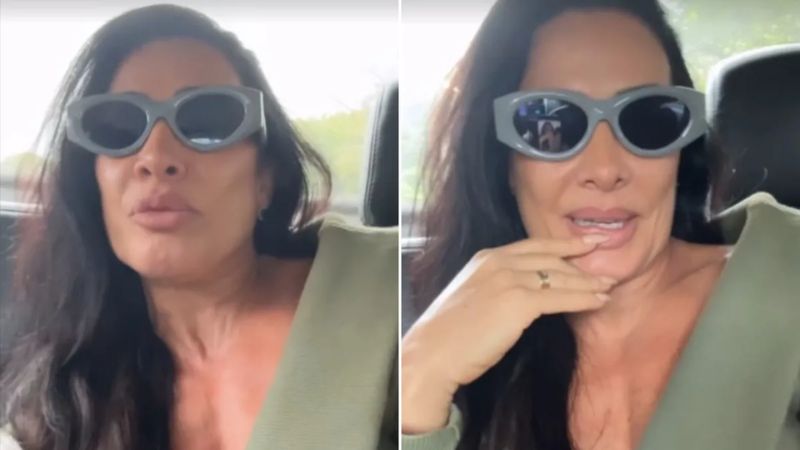 Scheila Carvalho relembra prejuízo financeiro e impacto pessoal causado por procedimento estético