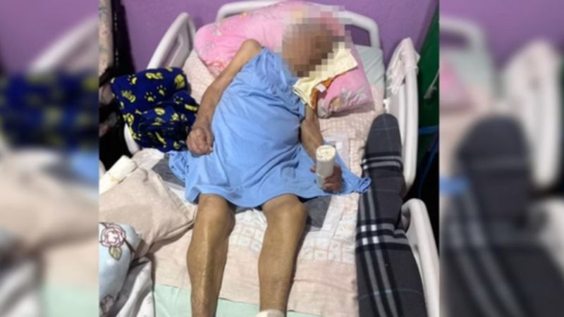 Enfermeira é investigada por amputar pé de idosa de 103 anos sem anestesia e com bisturi ‘cego’