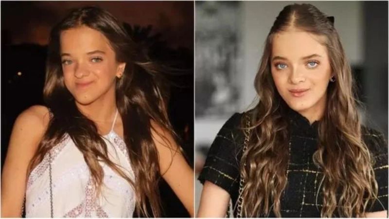 A transformação de Rafaella Justus: cirurgia e autoestima aos 15 anos