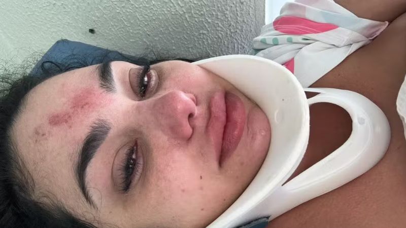 Mulher tem fratura cervical após acidente com bomba de piscina em Capão da Canoa, RS