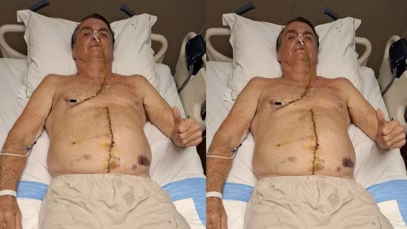 Bolsonaro segue internado na UTI em Brasília após cirurgia intestinal