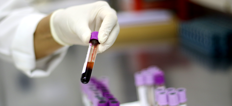 Ministério da Saúde descarta caso de gripe aviária em um trabalhador do Rio Grande do Sul