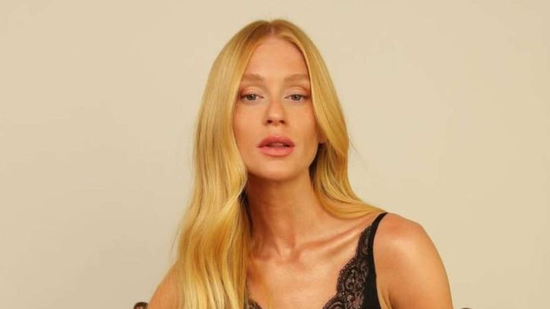 Marina Ruy Barbosa explica hematomas após evento em Cannes