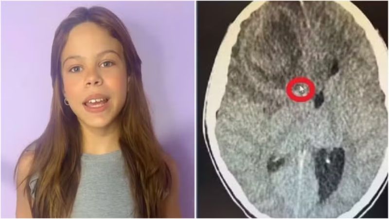 Laudo aponta infecção no cérebro como causa da morte da atriz mirim Millena Brandão