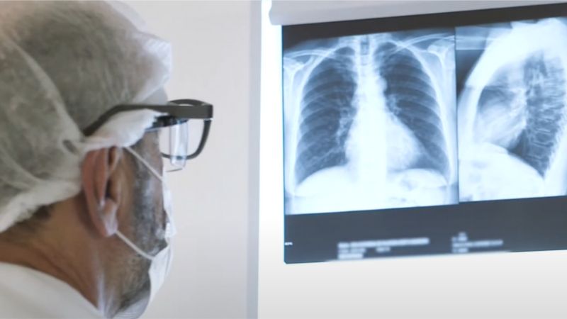 Doenças respiratórias matam mais de 5 mil na Bahia em 2025 e acendem alerta para cuidados no inverno