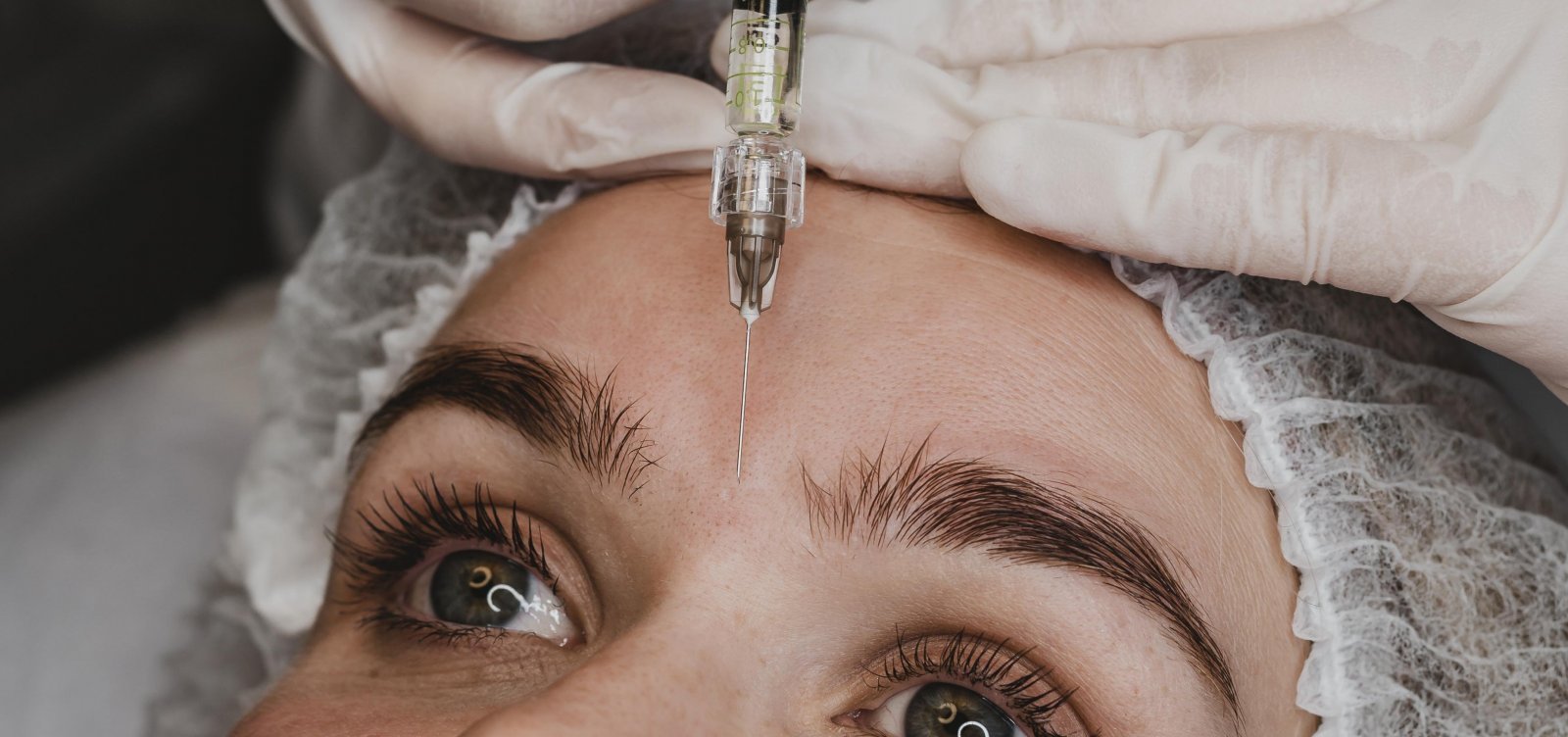Anvisa proíbe uso de lote falsificado de botox no Brasil