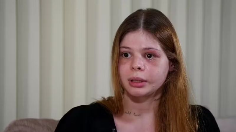 “O amor que quase me matou”: médica sobrevive a tentativa de feminicídio no dia do aniversário