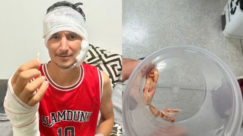 Peão sobrevive a ataque de onça no Pantanal e guarda garra como amuleto