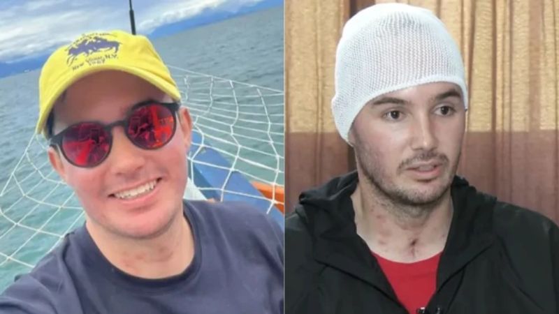 Motoboy que ficou cego após beber uísque com metanol recebe alta e relata drama: “Queimava”