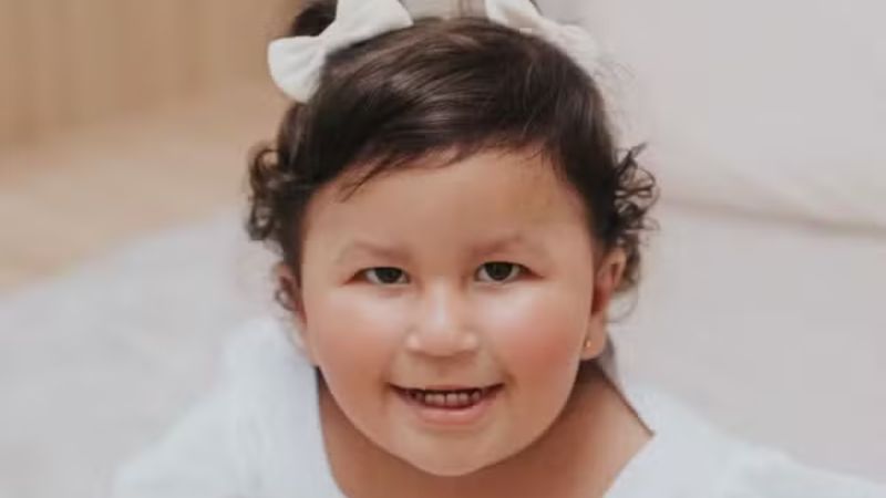 Síndrome de Prader-Willi: criança de 2 anos no Acre enfrenta fome insaciável e busca tratamento com hormônio