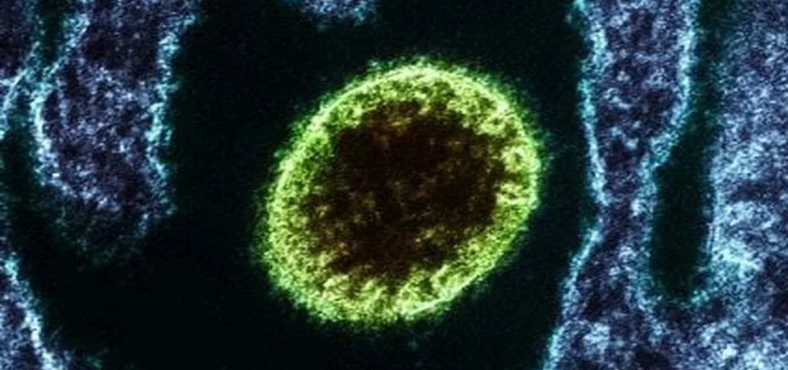 Ministério da Saúde afirma que casos de vírus Nipah na Índia não oferecem risco ao Brasil