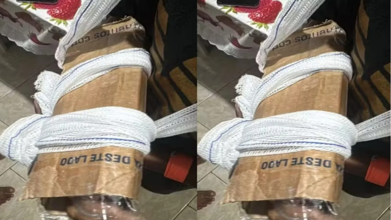 Criança com braço fraturado recebe imobilização improvisada em UPA no Rio de Janeiro