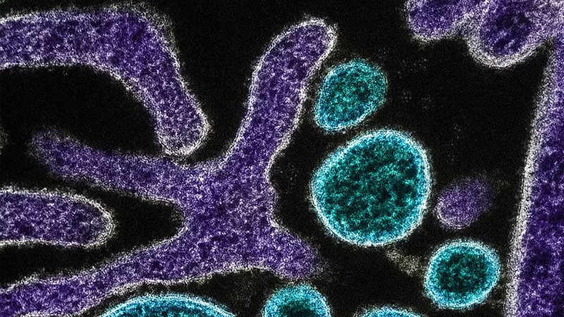 Surto de vírus Nipah na Índia reacende alerta global