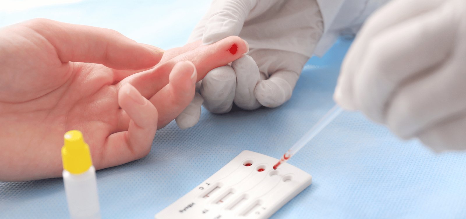 Fiocruz inicia estudo pioneiro para ampliar acesso à PrEP e prevenir HIV entre jovens em Salvador