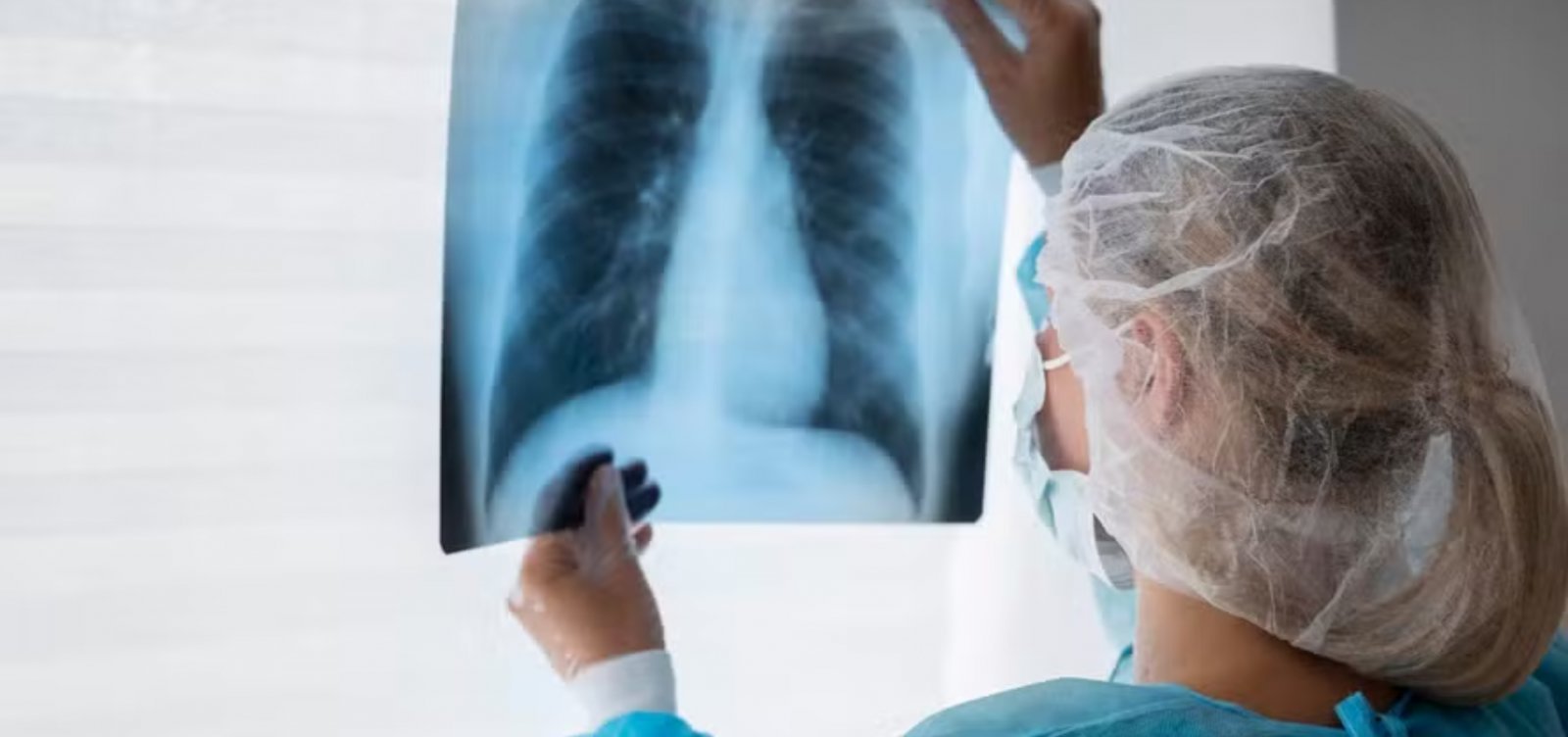 Anvisa aprova medicamento para tratamento de câncer de pulmão metastático